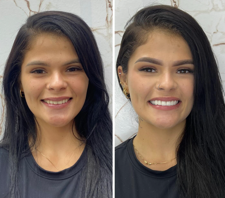 Antes e Depois - Transformação 7
